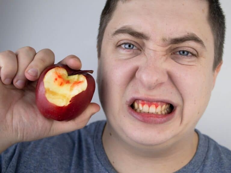 krvaveče dlesni in jabolko